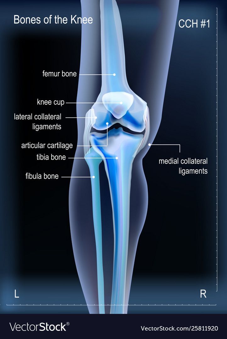 Orthopedics